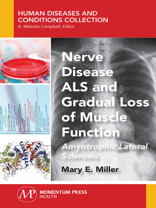 Title details for Nerve Disease ALS and Gradual Loss of Muscle Function by Mary E. Miller - Available